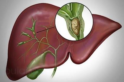 日本專家談腫瘤?膽道癌