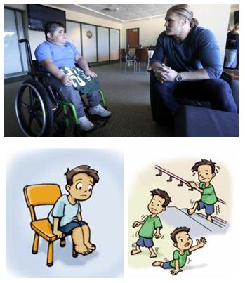 日本藤田醫科大學教授談罕見病DMD 新藥獲批！有望造福DMD患者！